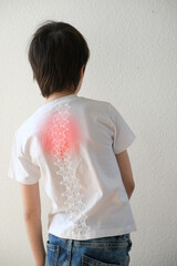 part of naked back of boy, child 10 years old in a white t-shirt , hunched over from back pain,...