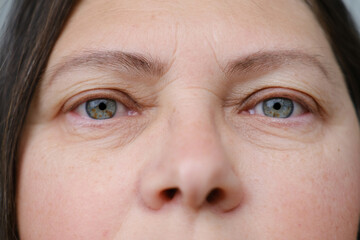 close up part mature female face, woman 50-55 years old looks carefully examines wrinkles around...