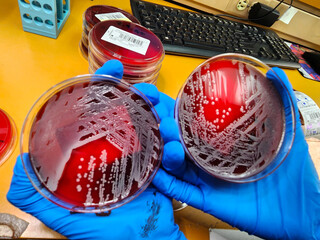 Staphylococcal bacterial colonies on blood agar culture plates