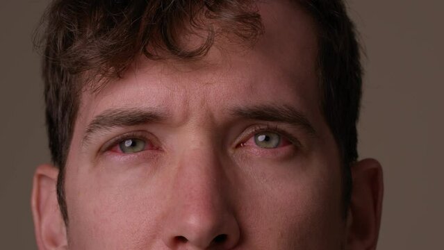 Man takes off glasses to reveal pink eye - close up on face