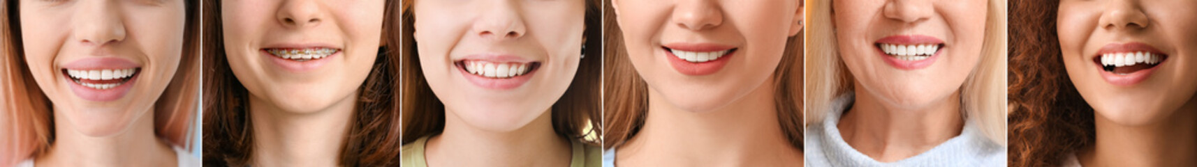 Collage of many women with healthy teeth, closeup