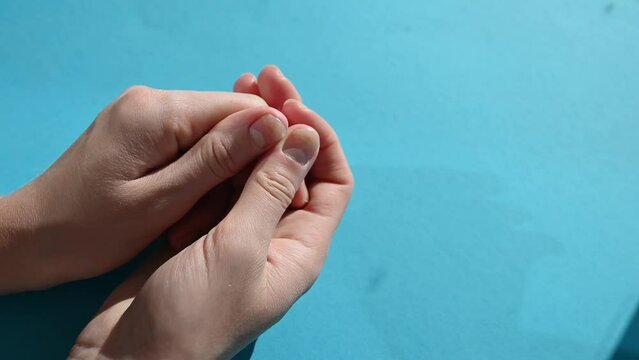 Hands with nail lesions - onycholysis,on a blue background.Separation of the nail plate from the nail bed after manicure