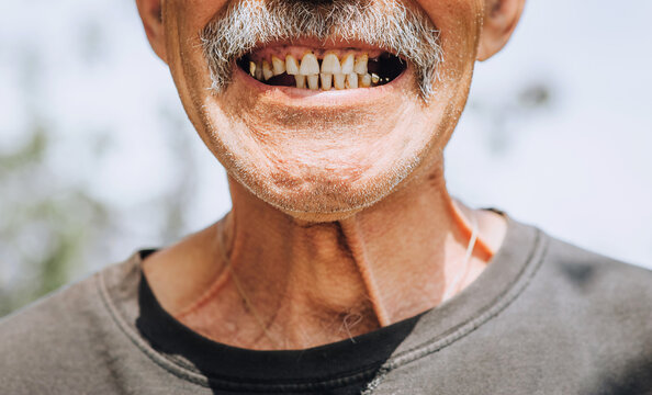 Photo, close-up portrait of the face of an old smiling gray-haired man with a mustache and rotten teeth.