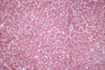 Histological Pancreas human, Liver human, Vermiform appendix human and Kidney Human under the microscope for education.