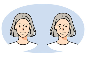 Old woman struggle with facial nerve palsy