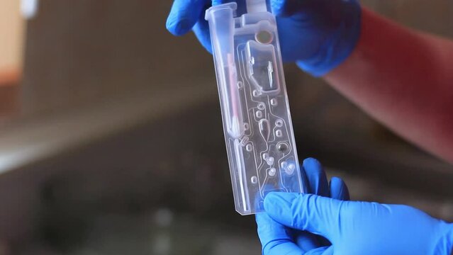 A woman's hand in a glove puts a probe for a dna test