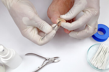 Inspection of the nails in the foot by the doctor in the doctor's office