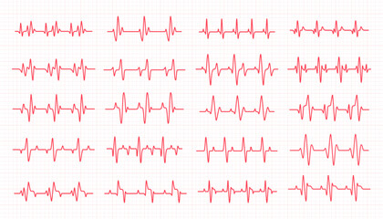 heart rhythm graph Checking your heartbeat for diagnosis