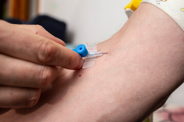 Inserting a intravenous dripper in a male arm,