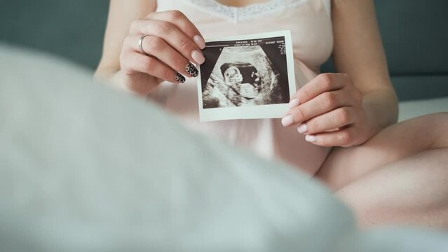 The pregnant girl holding an ultrasound picture in her hands while sitting on the bed	

