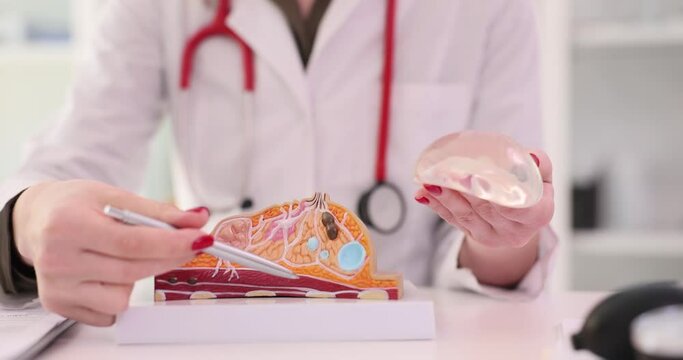 Doctor points pen to artificial model of breast holding silicone implant. Woman explains structure of affected female breast in clinic slow motion