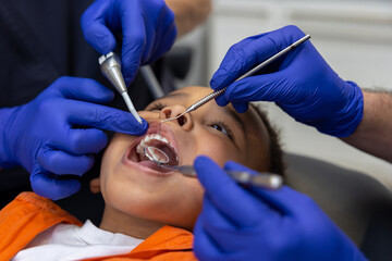 Fototapeta premium Close up of dentists working on teeth of a little boy