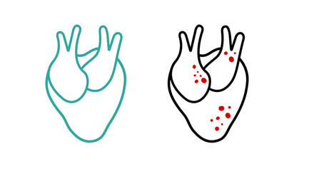 Obraz premium Healthy Heart and Ischemic Heart Disease minimalist lineart illustration. Blocked coronary artery, blood flow decreases, thrombus. Atherosclerosis. Acute Myocardial infarction. Vector flat isolated