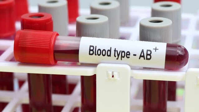 Blood type AB Rh positive test, blood sample to analyze in the laboratory, blood in test tube
