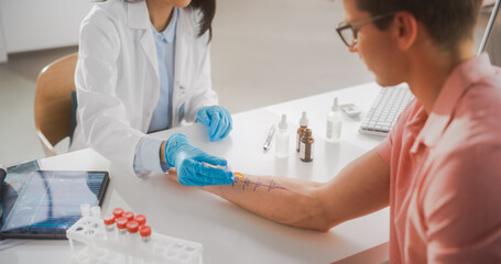 Close Up of a Patient Passing a Prick Scratch Allergy Test. Allergist Using Different Allergens on a Skin of a Young Man. Immunologist Diagnosing Allergy Triggers