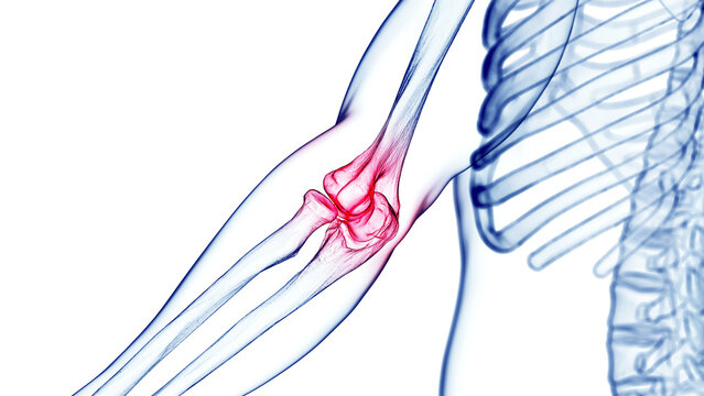 3d medical illustration of elbow pain