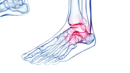 3D Rendered Medical Illustration of foot pain.