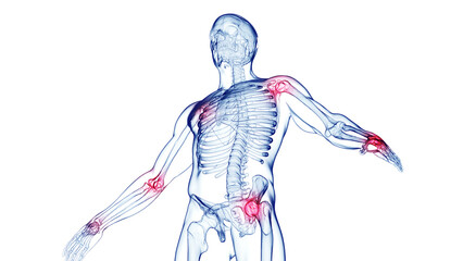 3d medical illustration of a man's joint pain - obrazy, fototapety, plakaty