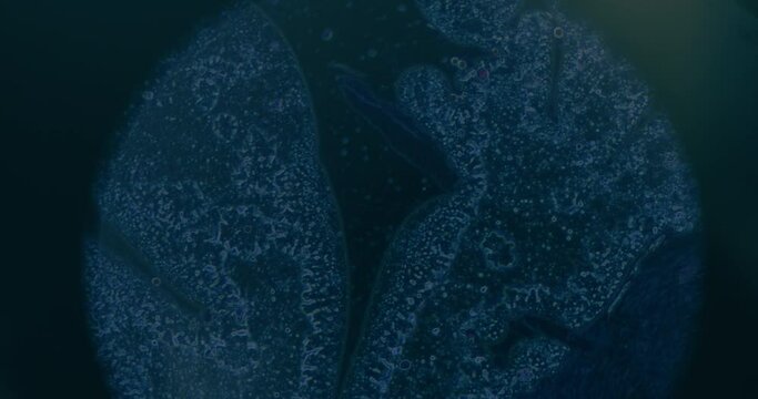 Cancer Cells Under Microscope At Laboratory