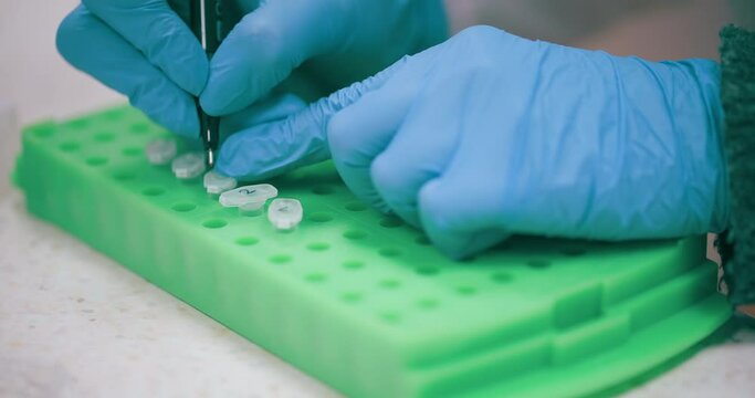 Scientist Working in Medical Laboratory Cancer Research Covic 19 Pandemic