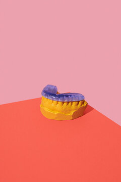 mouthguard in a dental mold