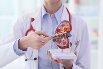 Doctor points pen to inflammation of kidney artificial model