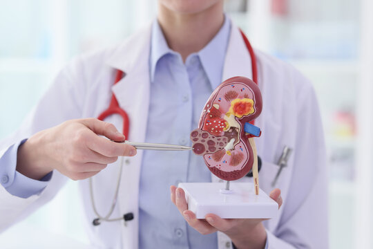 Doctor points pen to artificial model of kidney at lesson