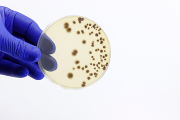 Doctor's or scientist's hand with a microbiological culture dish with colonies of a species of...