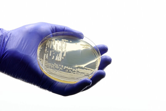 Gloved medical or scientific hand, with a microbiological culture of Candida auris yeast, an antimicrobial-resistant pathogen. 