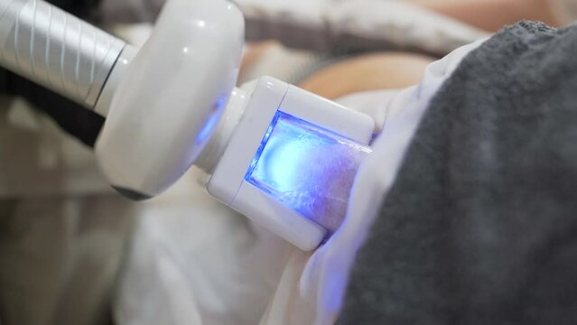 Woman receiving cryolipolysis treatment on abdomen cartridges for fat reduction. Close up,