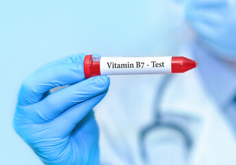 Fototapeta premium Doctor holding a test blood sample tube with vitamine B7 test.