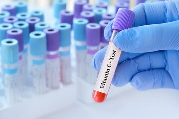 Doctor holding a test blood sample tube with Vitamin С test on the background of medical test tubes with analyzes.Banner.Copy space for text