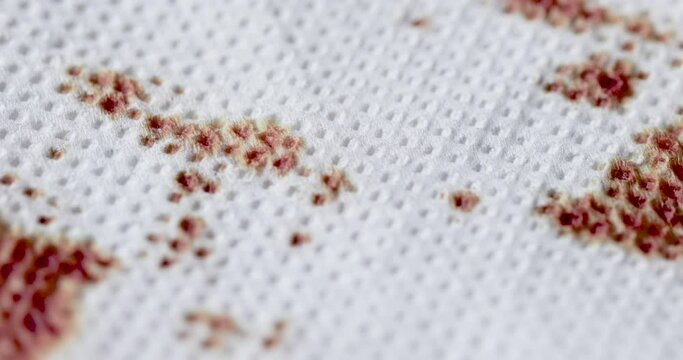 Close-up of blood seeping through gauze bandage