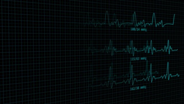 Animated EKG Heart Beat Pulse Line Displaying in Cardiograph Monitor