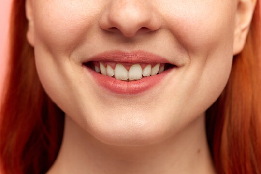 Cropped portrait with lower face of young woman with snow-white smile. Close up image. Model with well-kept, perfect skin. Teeth whitening