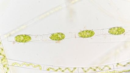 Asexual reproduction of Spirogyra sp. by forming zygospore. Fresh sampel without staining
