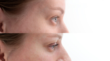 Before And After Eyelashes Lamination Of Caucasian Beautiful Young Woman, Closeup. Profile Side....