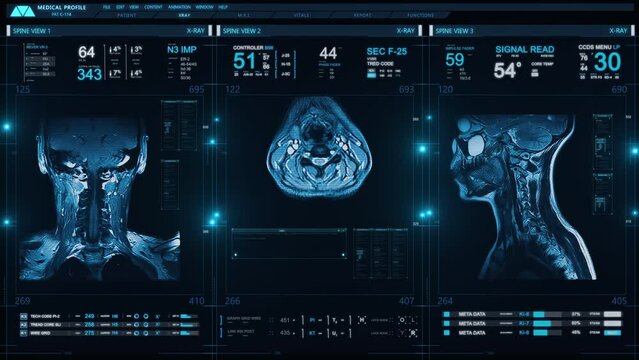 
Medical Profile of Patient Showing Neck MRI Scan. Animation Showing Top, Front, Lateral View. Vital Signs and Several Healthcare Information Charts and Data. Diagnosis Medical Data.