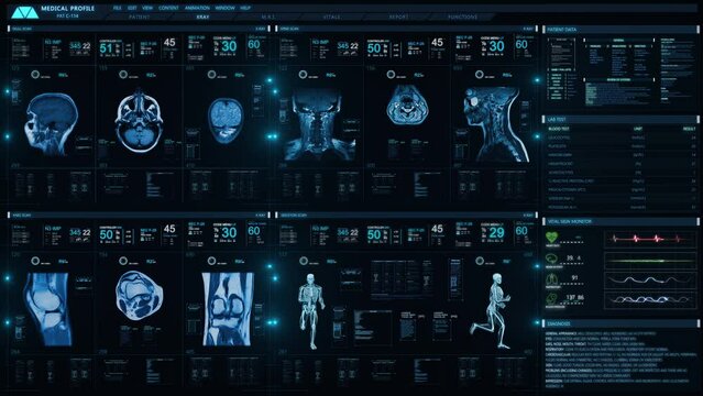 
Medical Profile of Patient Showing Knee, Head and Neck MRI Scan, 3D Model Animation Running and Vital Signs. Healthcare. Futuristic Technological Interface Analyzing Human Anatomy and Morphology. 
