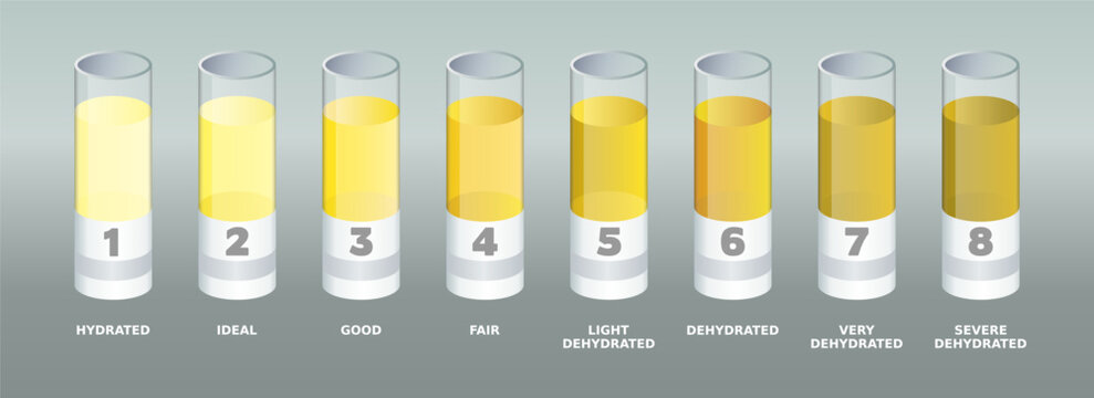 Urine color chart. Lab tubes with different urine colors samples. Dehydration levels. Hydration test explanation. Pee color diagram with numbers. Assessing medical condition. Vector illustration. 