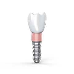 Close up of dental teeth implant. 3D rendering.