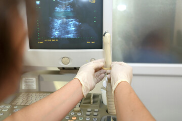 Vaginal ultrasound examination. A woman at the gynecologist for a check-up.   - obrazy, fototapety, plakaty