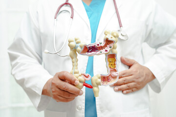 Intestine, doctor holding anatomy model for study diagnosis and treatment in hospital.