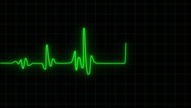 EKG Electrocardiogram Display Looping. Heart rate monitor electrocardiogram medical monitor.
