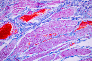 Histological Smooth muscle human under the microscope for education.