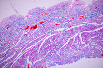 Histological Smooth muscle human under the microscope for education.