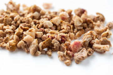 Kidney stones. Stones were removed from the patient's kidneys