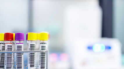 Medical blood tube on white table in hospital.Colorful tube with blur background.Medical analysis...
