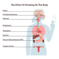 Obraz premium Diagram about health effect of cigarette smoking. Illustration about risk of smokers.