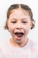 Little girl with rainbow braces